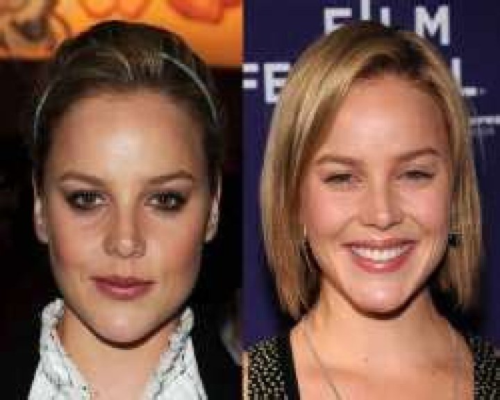 Abbie Cornish Plastic Surgery Before and After