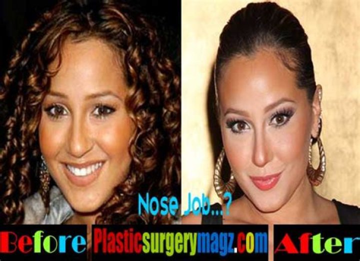 Adrienne Bailon Plastic Surgery Before and After