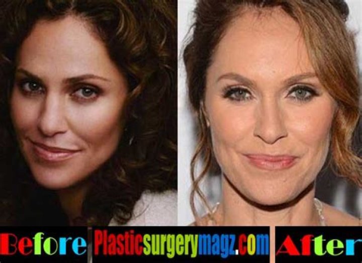 Amy Brenneman Plastic Surgery Before and After