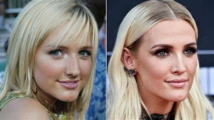 Ashlee Simpson Nose Job Plastic Surgery Before and After