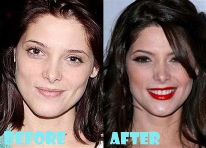 Ashley Greene Plastic Surgery Before and After