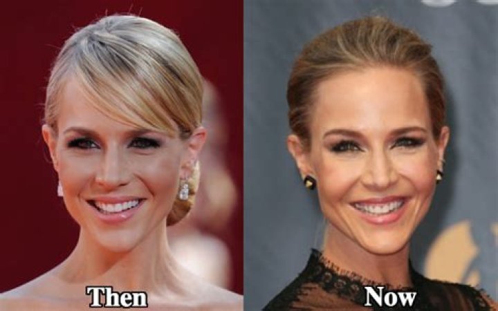 Julie Benz Breast Implants Plastic Surgery Before and After