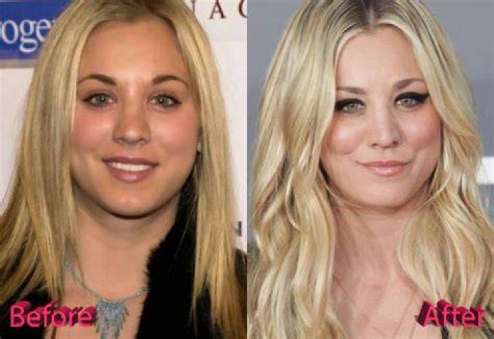 Kaley Cuoco Plastic Surgery: Cuoco's Steering Clear about Undergoing Procedures!