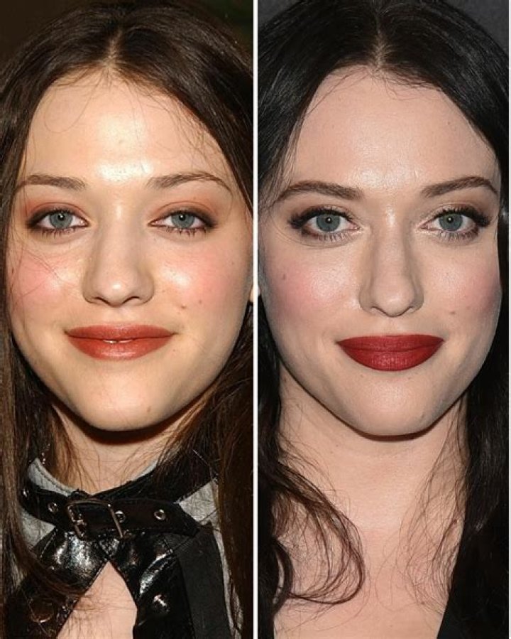 Kat Dennings Plastic Surgery Before and After