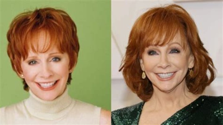 Reba McEntire Facelift Plastic Surgery Before and After