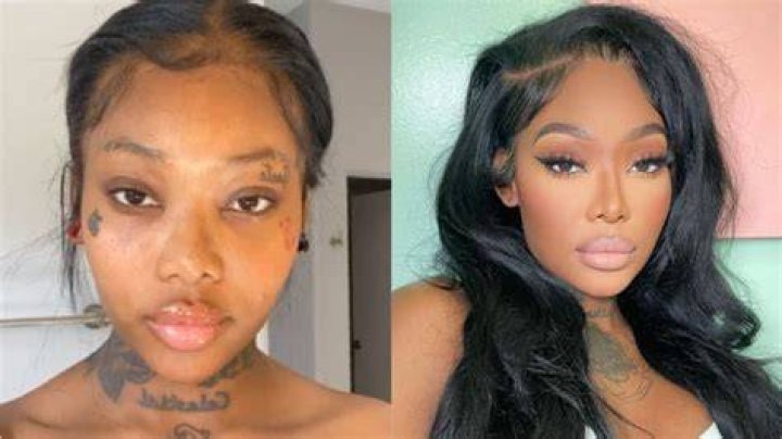 summer walker plastic surgery