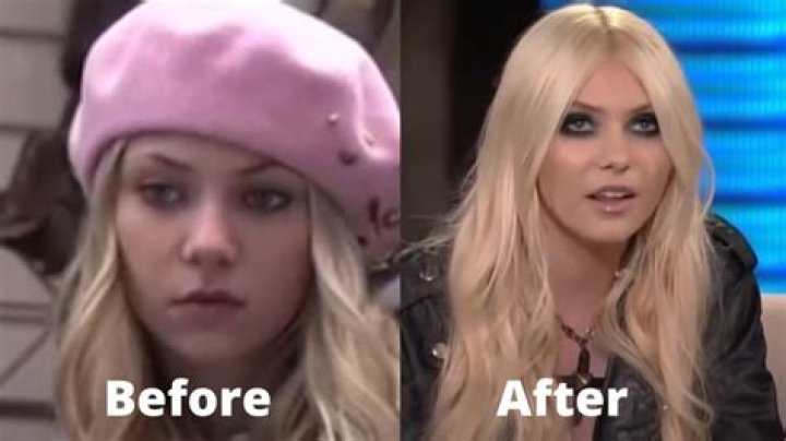 Taylor Momsen Breast Implants Plastic Surgery Before and After