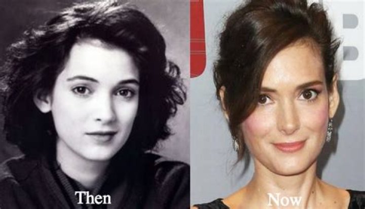 Winona Ryder Plastic Surgery Before and After